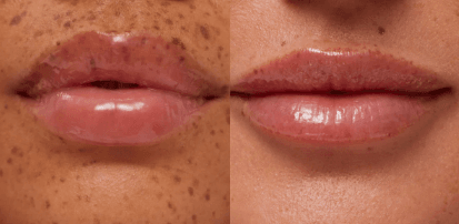 Lip Butter Balm