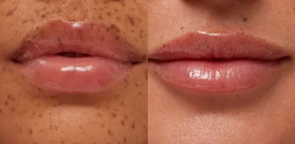 Lip Butter Balm